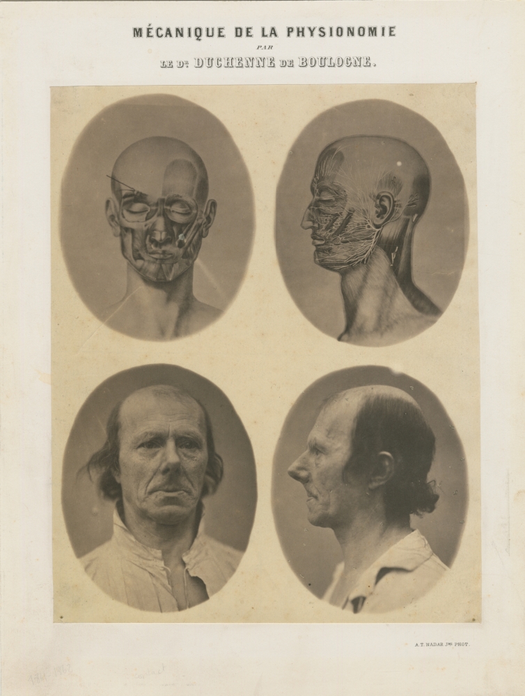DUCHENNE DE BOULOGNE and Adrien TOURNACHON (French, 1806-1875 & 1825-1903) "Mécanique de la Physionomie", before March 1857 Coated salt print from four collodion negatives Four images, each 10.4 x 8.3 cm, trimmed oval, on 25.6 x 18.0 cm paper, mounted on 29.4 x 22.3 cm card Titled and credited "par le Dr Duchenne de Boulogne" and "A.T. Nadar Jne phot." on the mount